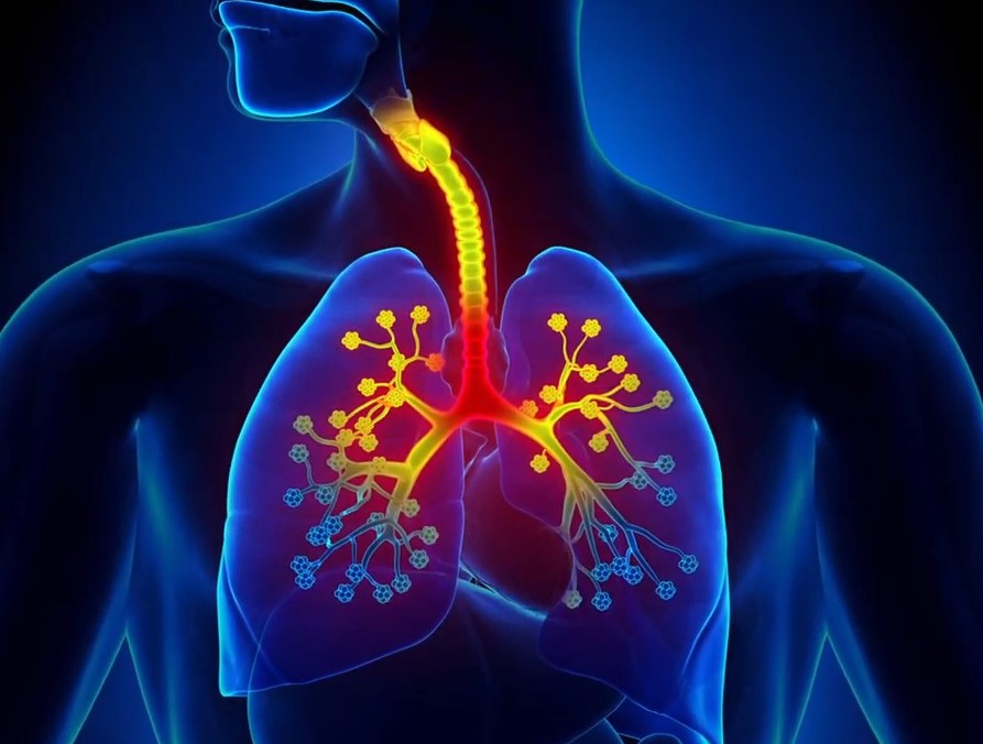 Kako da izlečite bronhitis