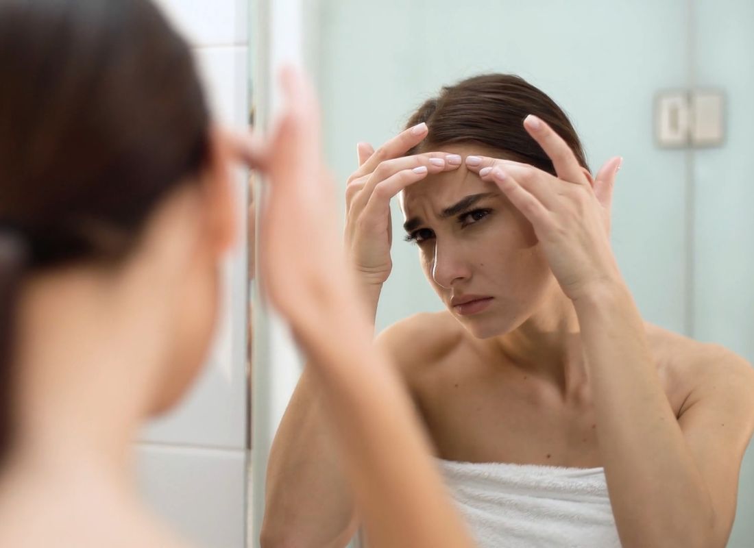 devojka cedi bubuljicu sa čela